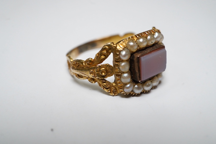 A Victorian yellow metal, carnelian and split pearl set ring, with carved split shoulders, size L, gross weight 2.7 grams. Condition - poor to fair